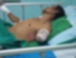 Miris ! Korban Tabrakan Kuday Diamputasi, Pihak Amen Dinilai Lepas Tanggung Jawab?